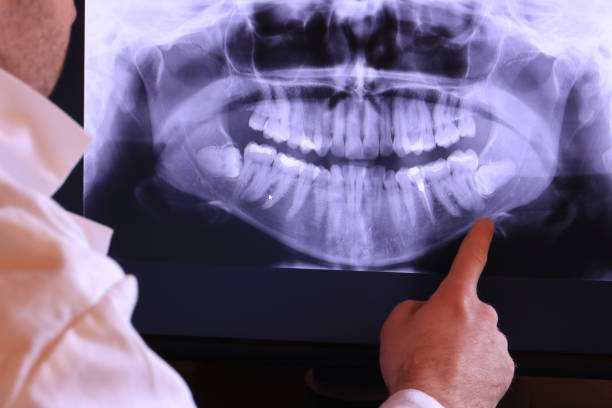 Best Urgent Dental Care for Toothache in Oran, MO